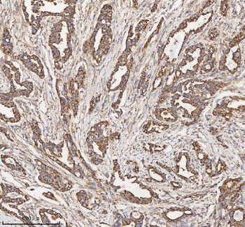 HADH Antibody