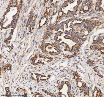 HADH Antibody