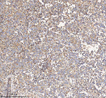 HADH Antibody