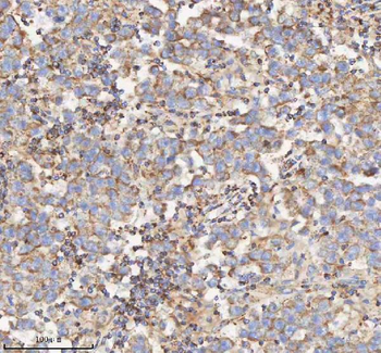 HADH Antibody