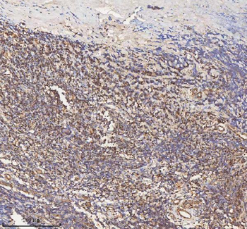 HADH Antibody