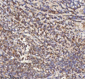 HADH Antibody