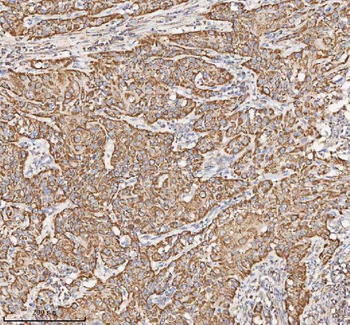 HADH Antibody