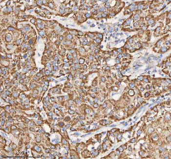 HADH Antibody