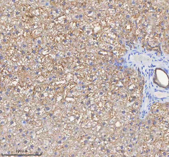 HADH Antibody
