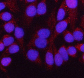 HADH Antibody