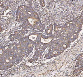HADH Antibody
