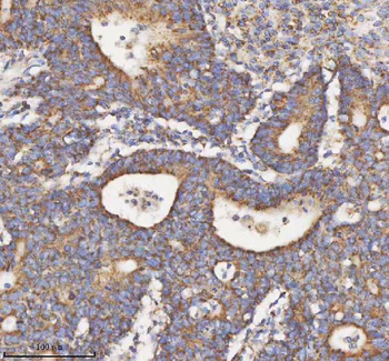 HADH Antibody