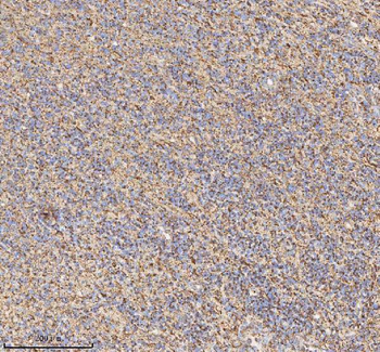 HADH Antibody