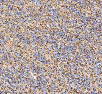 HADH Antibody