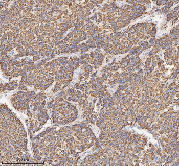 HADH Antibody