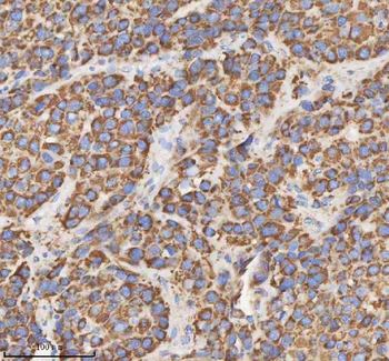 HADH Antibody