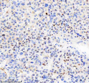 H2AFY2/MACROH2A2 Rabbit Polyclonal Antibody