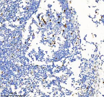 H2AFY2/MACROH2A2 Rabbit Polyclonal Antibody