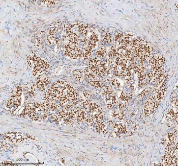 H2AFY/MACROH2A1 Antibody