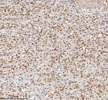 H2AFY/MACROH2A1 Antibody