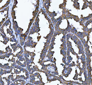 SEC61G Rabbit Polyclonal Antibody