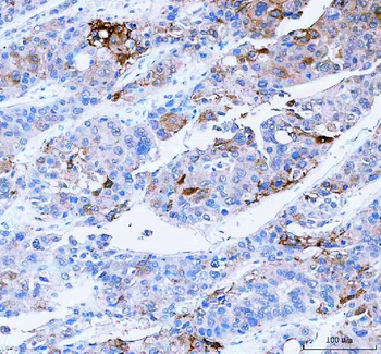 SCD Rabbit Polyclonal Antibody