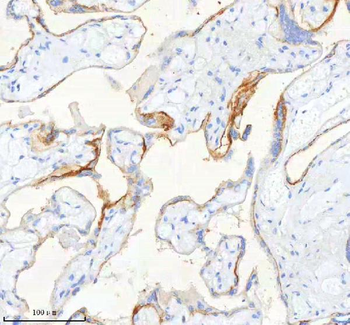 SCD Rabbit Polyclonal Antibody