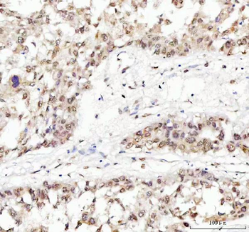 TDP-43/TARDBP/TDP Rabbit Polyclonal Antibody