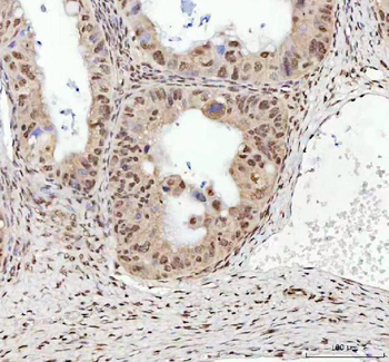 TDP-43/TARDBP/TDP Rabbit Polyclonal Antibody