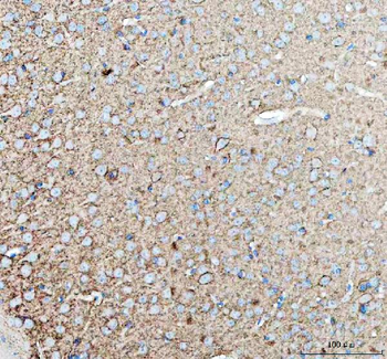 Tenascin-R TNR Rabbit Polyclonal Antibody