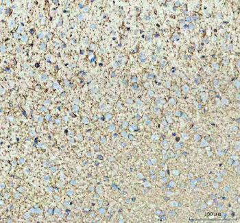 Tenascin-R TNR Rabbit Polyclonal Antibody