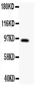 DISC1 Rabbit Polyclonal Antibody