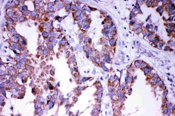 DISC1 Rabbit Polyclonal Antibody