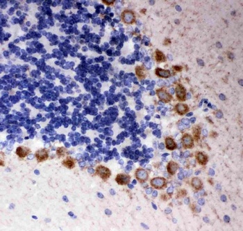 DISC1 Rabbit Polyclonal Antibody