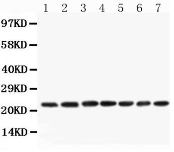 CNTF Rabbit Polyclonal Antibody