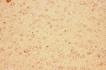 CNTF Rabbit Polyclonal Antibody