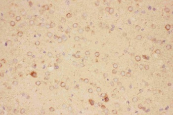 CNTF Rabbit Polyclonal Antibody