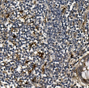 VEGF/VEGFA Rabbit Polyclonal Antibody