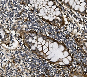 VEGF/VEGFA Rabbit Polyclonal Antibody