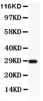 BDNF Rabbit Polyclonal Antibody