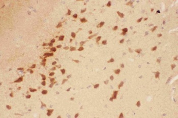 BDNF Rabbit Polyclonal Antibody