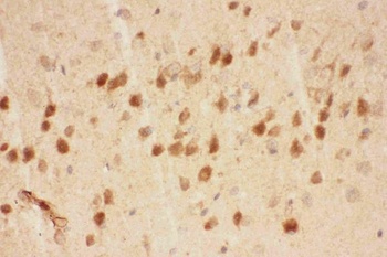 BDNF Rabbit Polyclonal Antibody