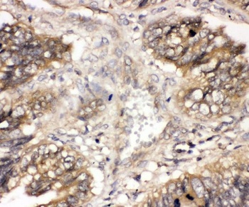 CBL Rabbit Polyclonal Antibody