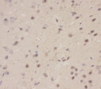 CBL Rabbit Polyclonal Antibody