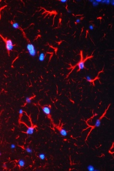 GFAP Antibody