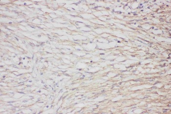 GFAP Antibody