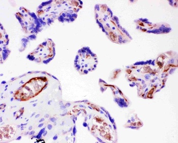 Integrin beta 1/ITGB1 Rabbit Polyclonal Antibody