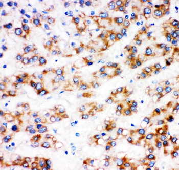 alpha 1 Fetoprotein/AFP Rabbit Polyclonal Antibody