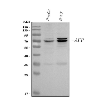 alpha 1 Fetoprotein/AFP Rabbit Polyclonal Antibody
