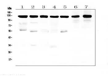 beta Amyloid/APP Antibody