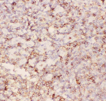 CD43/SPN Antibody