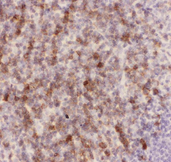 CD43/SPN Antibody
