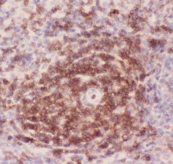 CD43/SPN Antibody
