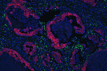 Collagen IV/COL4A1 Antibody